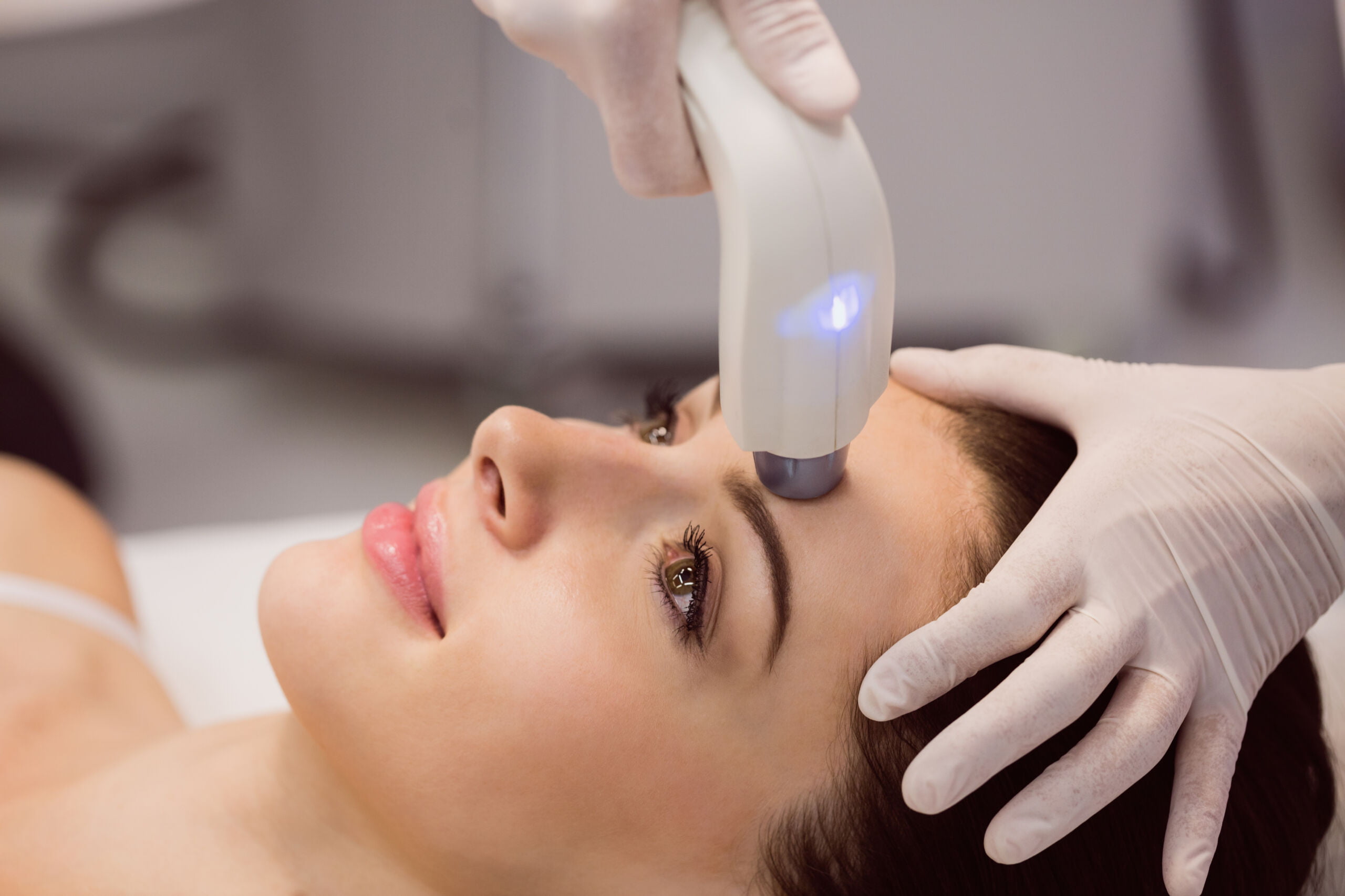 Microneedling