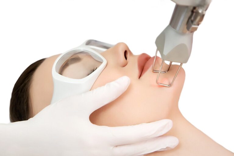 CO2 Laser Facial Cambridge